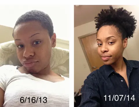 Antes e depois de crescimento capilar