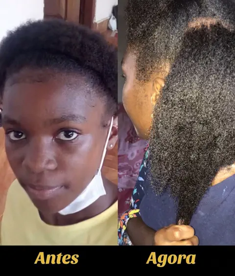 Resultado antes e agora do cabelo